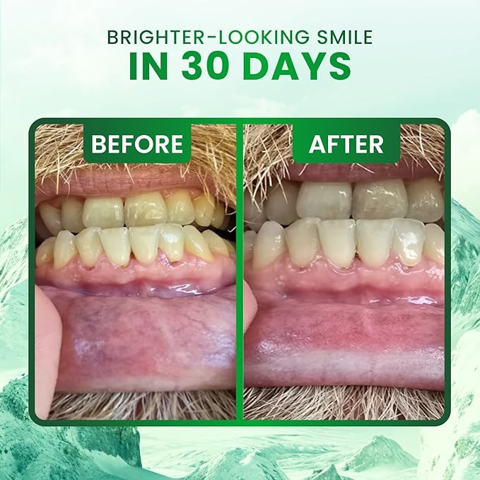 Larineco Remineralizing Gum with Nano Hydroxyapatite & Xylitol – Sugar-Free Cinnamon Xylitol Gum – Plastic-Free, Dye-Free, Aspartame-Free – Natural Base – 18 Pieces (18 Count (Pack of 2), Peppermint)