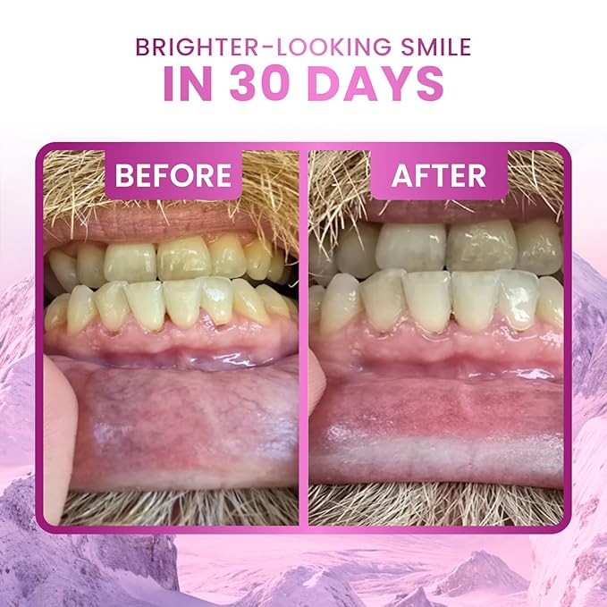 Larineco Remineralizing Gum with Nano Hydroxyapatite & Xylitol – Sugar-Free Cinnamon Xylitol Gum – Plastic-Free, Dye-Free, Aspartame-Free – Natural Base – 18 Pieces (18 Count (Pack of 2), Bubble Gum)