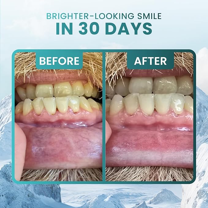 Larineco Remineralizing Gum with Nano Hydroxyapatite & Xylitol – Sugar-Free Xylitol Gum – Plastic-Free, Dye-Free, Aspartame-Free – Natural Base – 36 Pieces, Mastic Mint