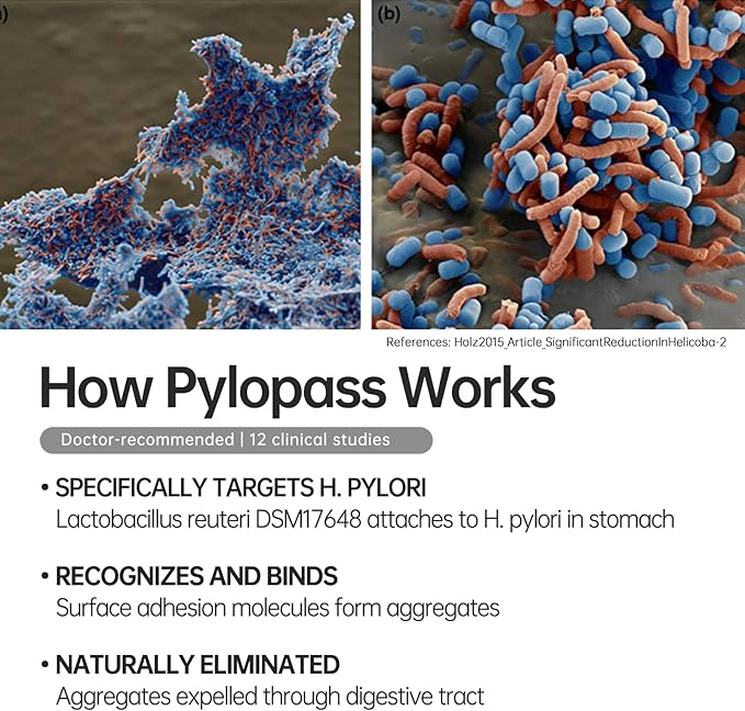 5 in 1 High Potency H. Pylori Treatment Probiotics - Gastritis Support - 1 Per Day - Pylopass Lactobacillus Reuteri DSM17648 - No Refrigeration Needed - Made in Germany