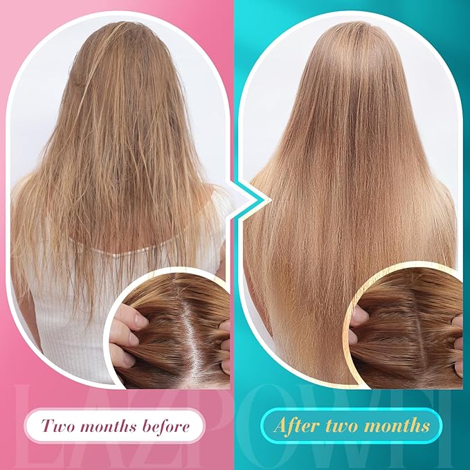 Biotin Gummies -Hair Skin and Nails Vitamins for Men & Women, Vegan Vitamin B7, Supports Hair Growth and Stronger Nails,30 Day Supply-Strawberry-60 Counts