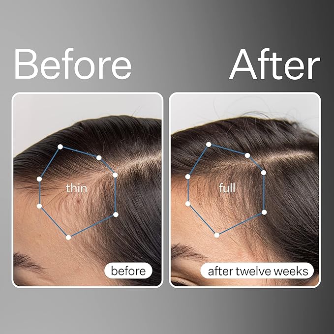 Act+Acre Cold Processed Stem Cell Scalp Serum - Promotes Thicker and Fuller-Looking Hair - Soothes and Hydrates the Scalp - Sulphate and Paraben Free - Aloe Vera for Improved Scalp Health - 1 fl oz.