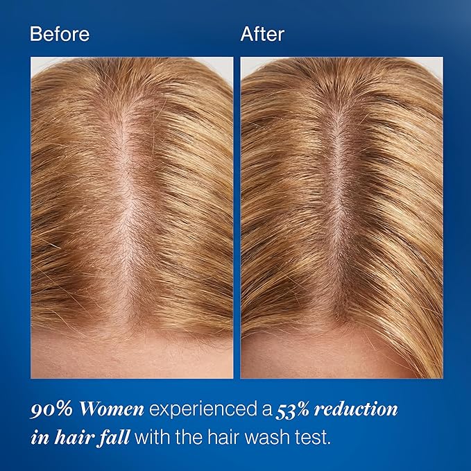 Be Bodywise Biotin 10000mcg Gummies | Hair Nail and Skin Vitamins | Biotin for Hair Growth for Women | Refined Sugar Free | 60 Day Pack (1 Gummy/Day)